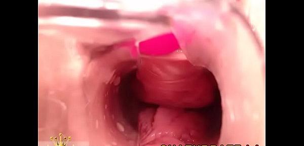  Gyno Cam Close-Up Vagina Cervix Siswet19 — my chat www.girls4cock.comsiswet19